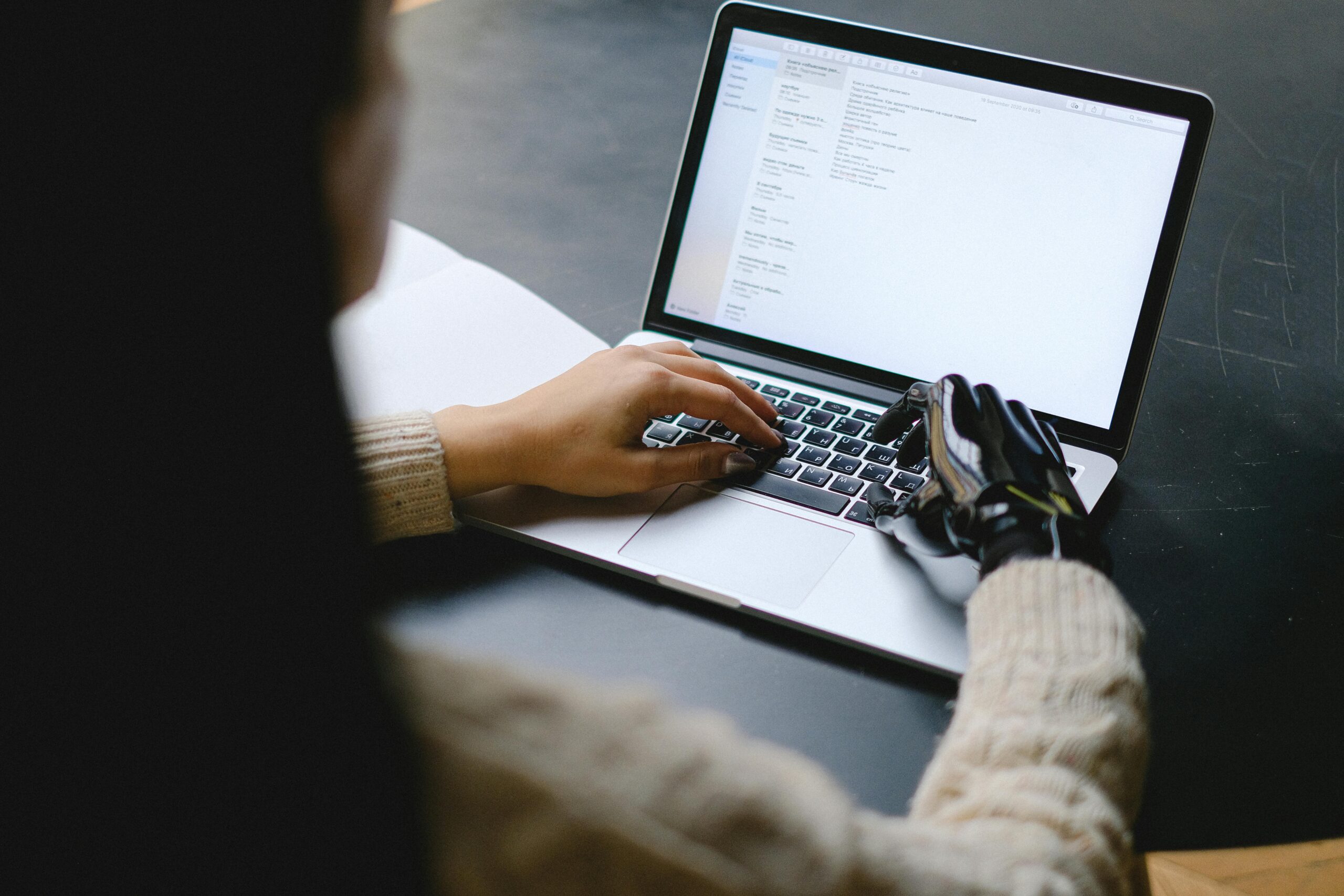 A person with a prosthetic hand types on a laptop keyboard while working at a desk.